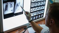 Doc. dr Nebojša Marić: Ako vas boli rame treba vam snimak pluća, a ne fizijatar