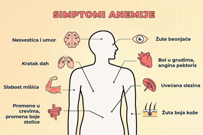simptomi anemije grafika
