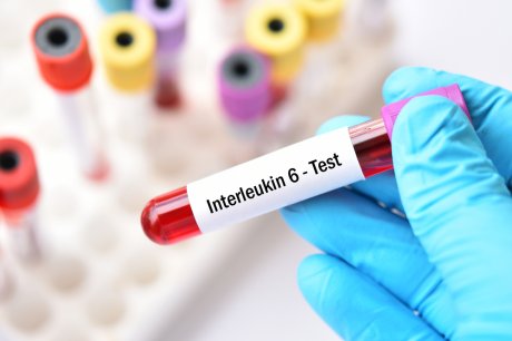 interleukin 6