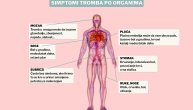 Tromb može da krene čak i u stanju mirovanja