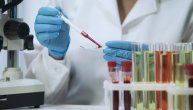Šta je elektroforeza proteina u krvi, kojim pacijentima se preporučuje ovaj test
