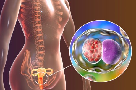 seksulano prenosive bolesti