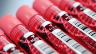 Novi test krvi mogao bi da dijagnostikuje depresiju i bipolarni poremećaj