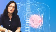 Dr Aleksandra Pikula: Karcinom dojke sve češći i u periodu menopauze