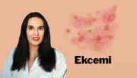 Suva koža koja svrbi i crveni znak je dermatitisa: Ekcem se leči, a preventiva je najvažnija