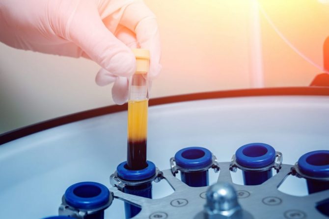 rekovalescentna plazma