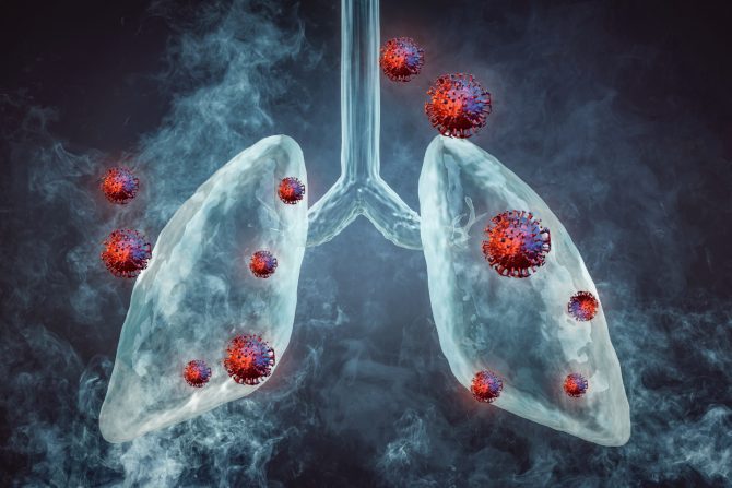 citokinska oluja -pluća- covid 19- korona virus