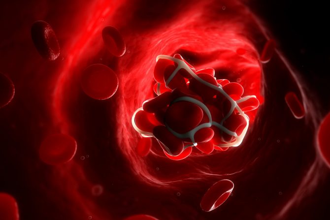 krvni ugrušci covid 19 vakcina