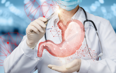 Smanjivanje želuca- operacija- skidanje kilograma