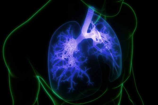 sarkoidoza- pluća-bolest