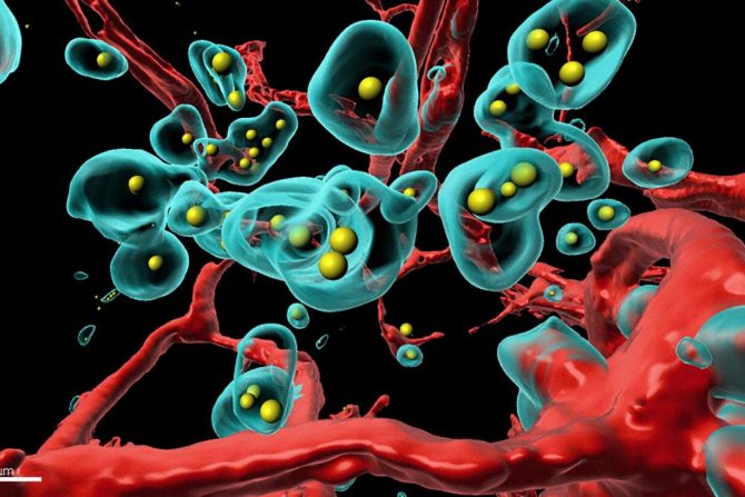 tumor- terapija-adenovirus