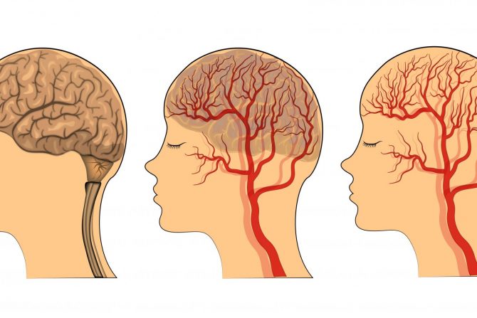 mozak-krvotok-gojaznost