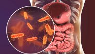 Ešerihija koli izaziva infekciju koja se dugo leči, dr Čomagić kaže da žene češće imaju problem