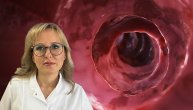 Ulcerozni kolitis se i u Srbiji može lečiti biološkom terapijom, dr Tamara Milovanović je detaljno opisuje