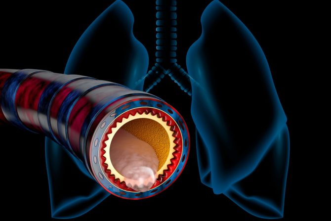 sluz- gusta sluz-bakterije