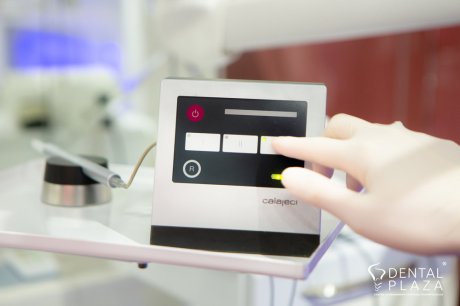 zubni - implantant- titanijumski šraf-koren zuba