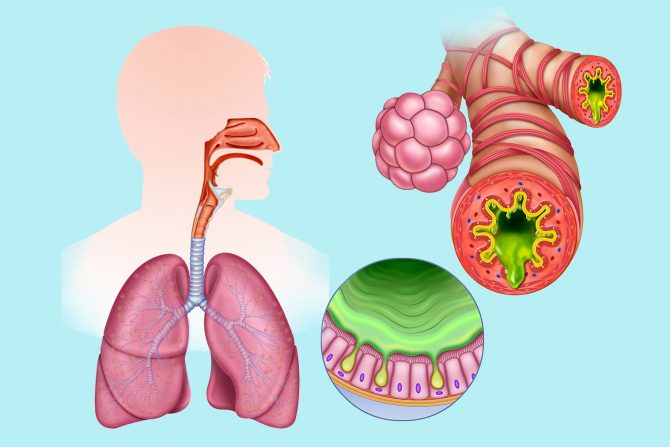 Postnazalna sekrecija - sluz- kašalj-knedla u grlu