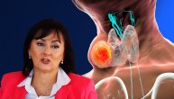 Nodusi ili čvorići na štitnoj žlezdi zapravo su tumori, a dr Jelica Bjekić Macut ističe da su najčešći kod žena