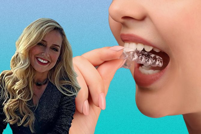 bruksizam-škripanje zubima-škrgutanje zubima