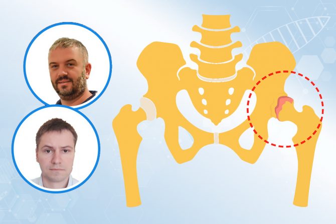 koksartroza-kukovi-propadanje hrskavice