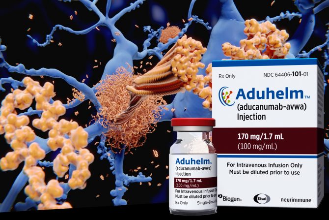 alcahjmerova bolest- novi lek- aduhelm