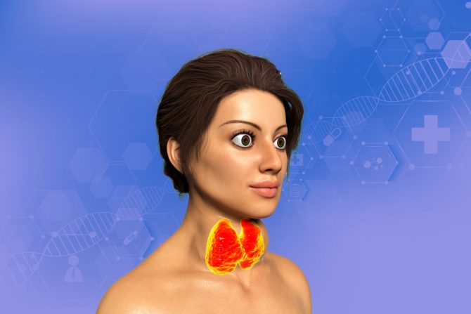 gravesova bolest-ispupčenje očiju-štitna žlezda