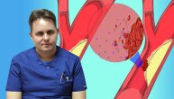Šta je mehanička trombektomija i kada se u slučaju moždanog udara primenjuje, objašnjava dr Ivan Vukašinović