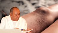 Alergija na sunce može da skrati odmor, a dr Lazarević savetuje kako da ne pokvarite letovanje