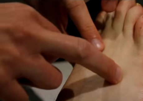 Zu Lin Qui, akupresura