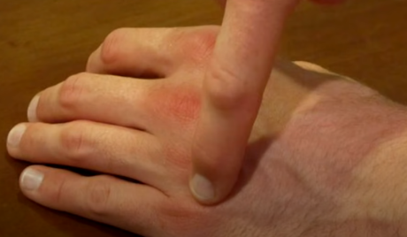 Zhong Zu, akupresura