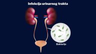 Bazeni su izvorište bakterija, kaže dr Miljković, jer većina urinira u vodi a oko 90 odsto ljudi se ne tušira pre ulaska