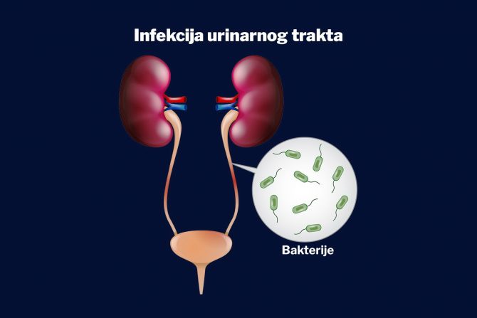 bazeni-infekcije-urinarne infekcije-bakterije