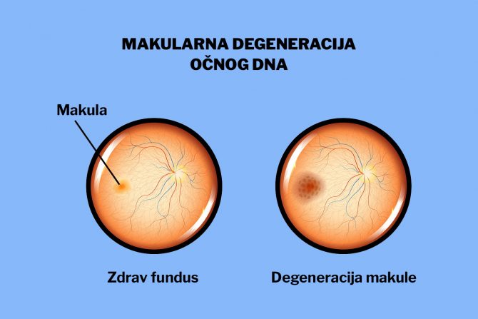 makula-žuta mrlja-očno dno
