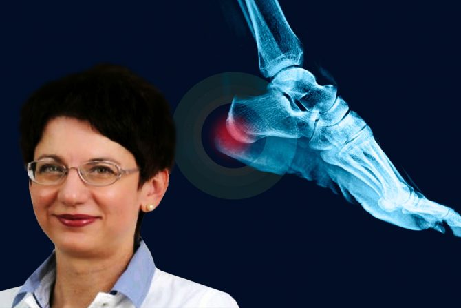 petni trn-bol u peti- ahilova tetiva