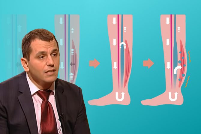 dr srđan babić-oticanjenogu -vrućina-leto