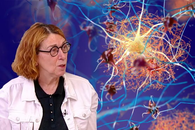 alchajmerova bolest - dr elka stefanova-