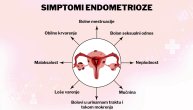 Endometrioza je benigno stanje, ali može biti uzrok ozbiljnih tegoba
