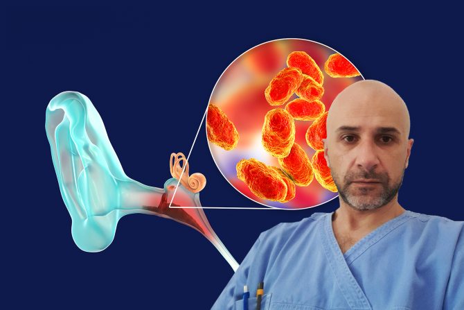 Dr Bojan Perišić, otitis, uvo