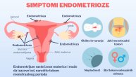 Endometrioza se prepoznaje na osnovu nekoliko vrlo karakterističnih simptoma