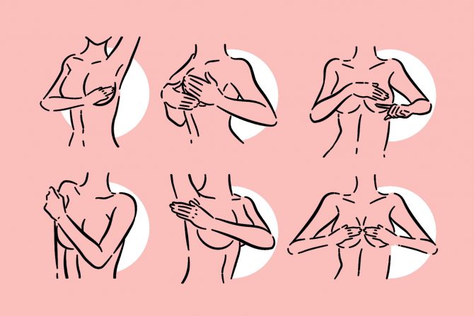 samopregled-dojke-testisi-preventiva