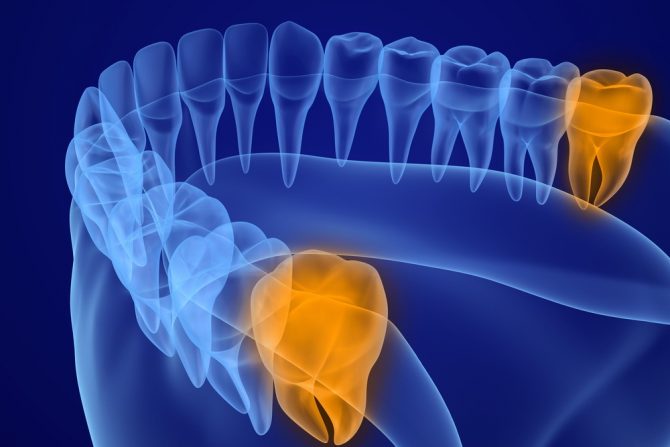 umnjaci-zubi-nepravilan rast-čulo ukusa