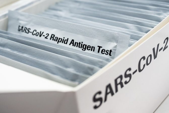 brzi antigenski test - ovlašćene laboratorije- mikrobiloške laboratorije