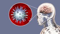 Herpes zoster može da ugrozi vid, ako dospe na lice odmah treba ići kod lekara