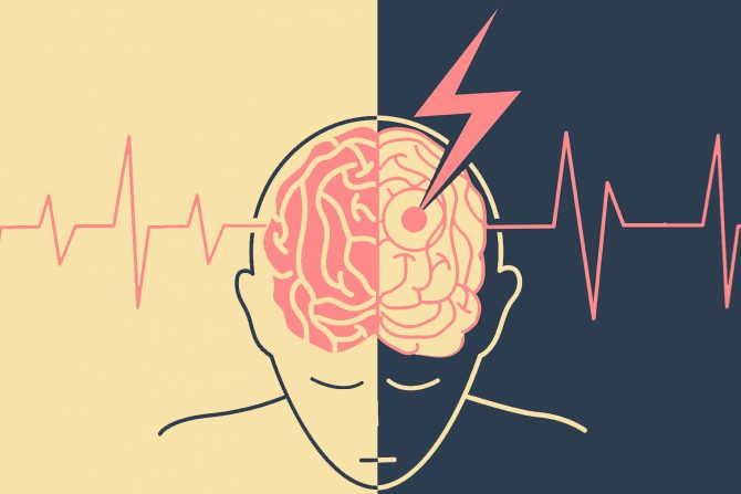 moždani udar - oporavak- terapije