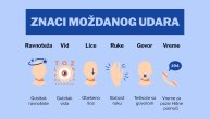 Moždani udar najbrže se utvrđuje FAST testom