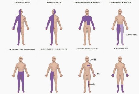 Trnjenje, lezije, simptomi