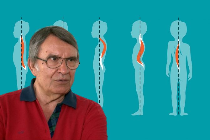 kriva kičma kod dece- nepravilno sedenje- deformitet kičme