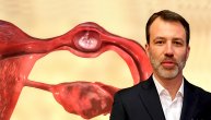 Vanmaterična trudnoća može da bude uzrokovana i izborom kontracepcije, poručuje dr Ivan Bojović