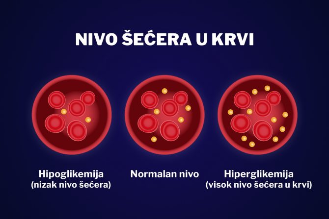 dijabetes - hipoglikemija-nivo šećera u krvi
