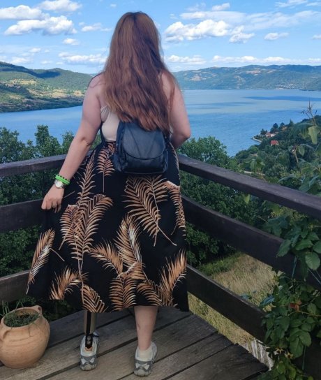 bojanaćorolić-amputirana noga-veštačka noga